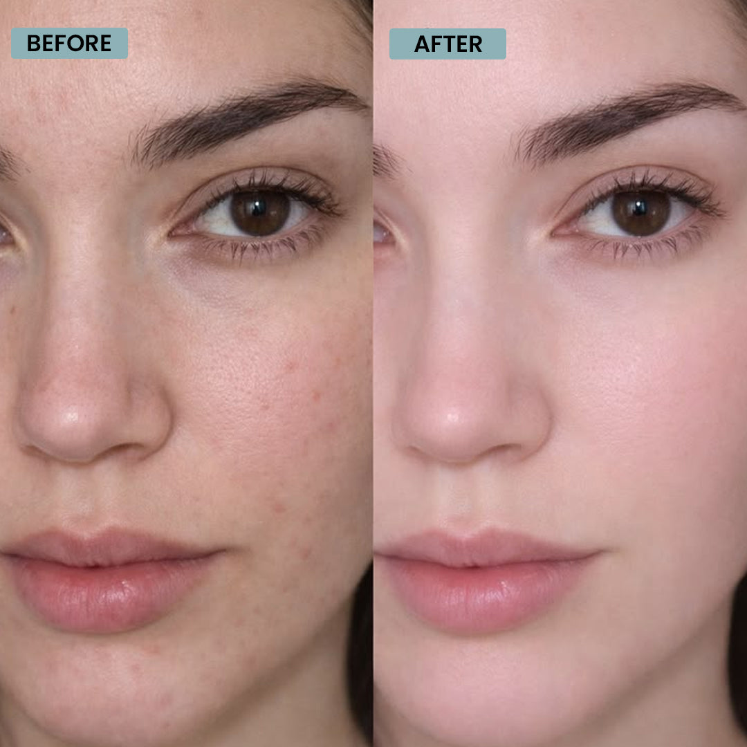 Niacinamide Serum