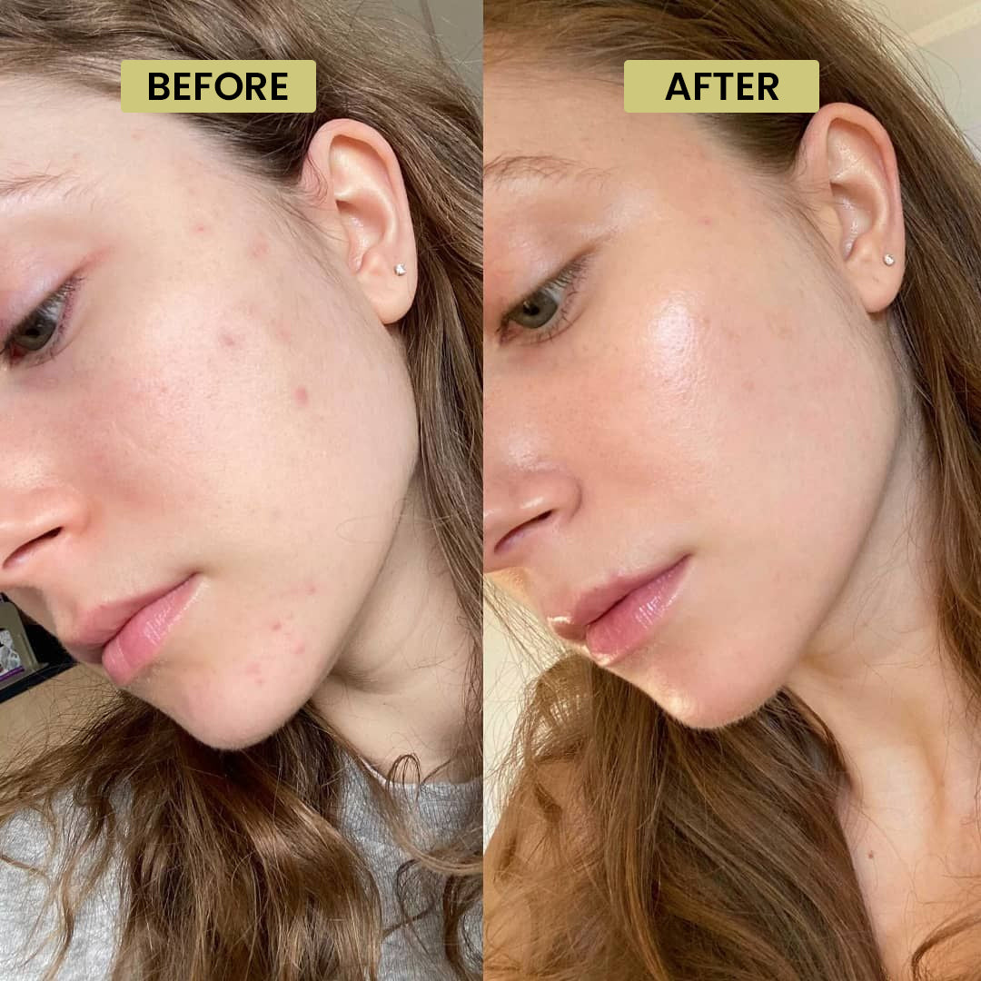 Vitamin C Serum