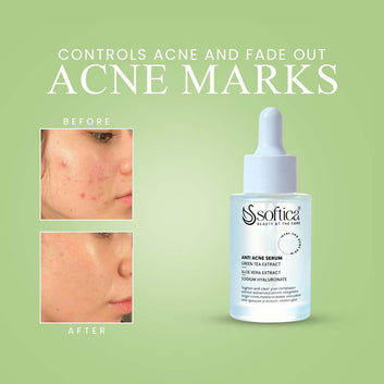 Anti Acne Serum